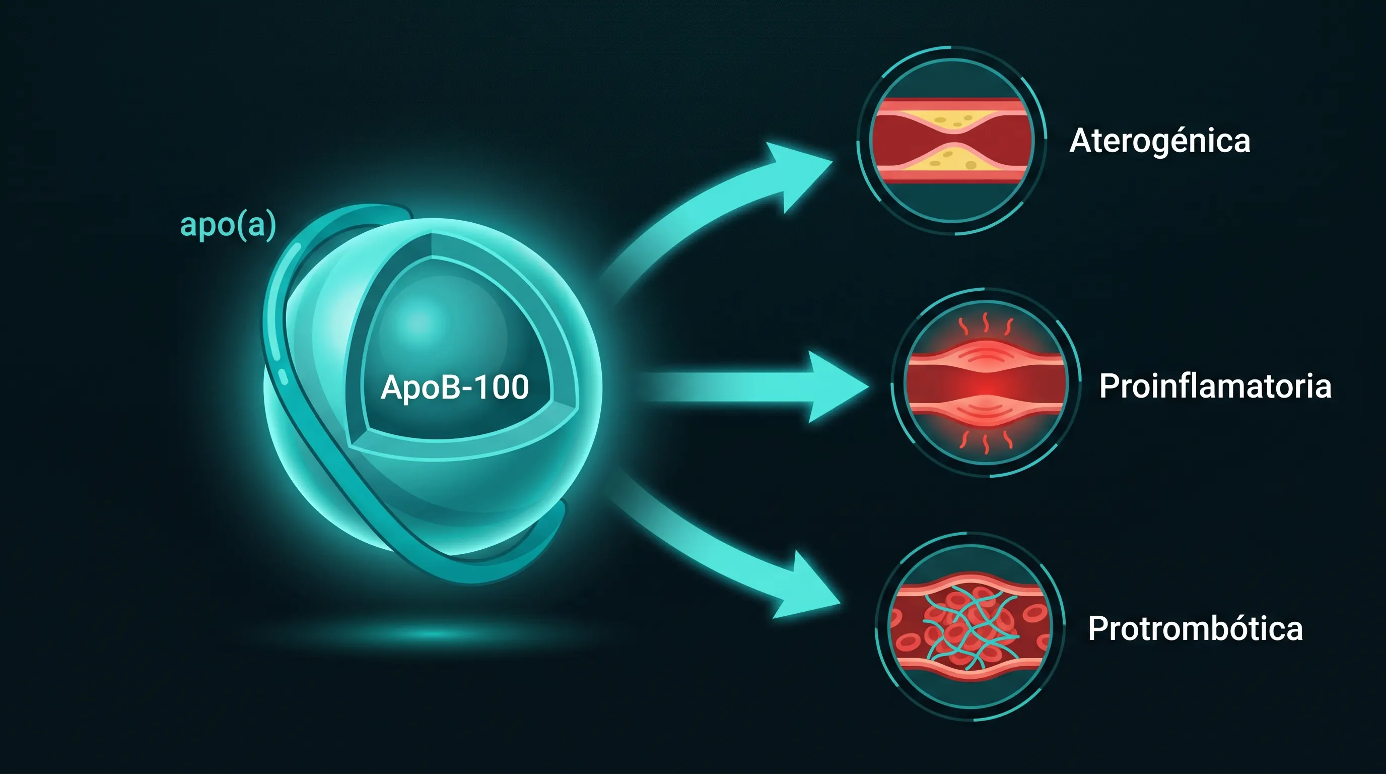 Diagrama de la lipoproteína(a): una partícula LDL con la apolipoproteína(a) unida a la ApoB-100, con tres vías marcadas como aterogénica, proinflamatoria y protrombótica.
